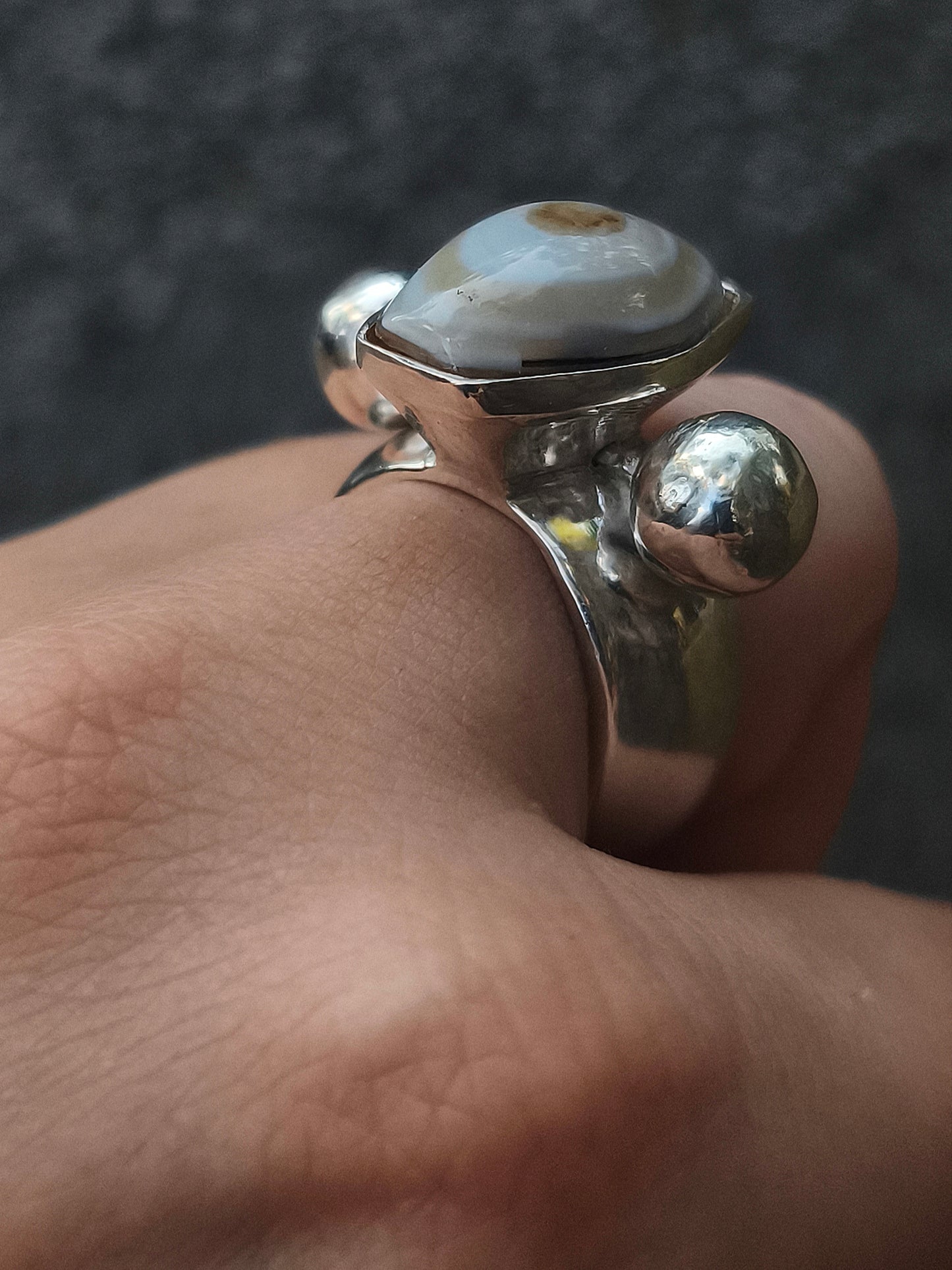 Third eye or the anxiety ring